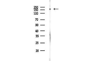 anti-Aquarius Homolog (AQR) antibody