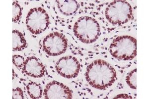 Immunohistochemistry (Paraffin-embedded Sections) (IHC (p)) image for anti-Protein Kinase, DNA-Activated, Catalytic Polypeptide (PRKDC) (pSer2056) antibody (ABIN7606746)