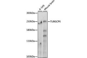 Western blot analysis of extracts of various cell lines, using TUBGCP6 antibody (ABIN7271055) at 1000 dilution. (GCP6 Antikörper  (AA 600-900))