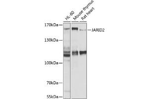 Western blot analysis of extracts of various cell lines, using J antibody (ABIN6129402, ABIN6142653, ABIN6142654 and ABIN6225131) at 1:1000 dilution. (JARID2 Antikörper  (AA 1027-1246))