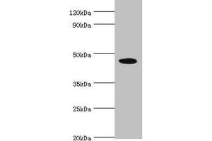 Western blot All lanes: STK32A antibody at 5 μg/mL + HepG2 whole cell lysate Secondary Goat polyclonal to rabbit IgG at 1/10000 dilution Predicted band size: 47, 20, 42 kDa Observed band size: 47 kDa (STK32A Antikörper  (AA 1-166))