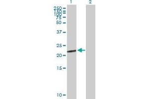 Western Blot analysis of CGB5 expression in transfected 293T cell line by CGB5 MaxPab polyclonal antibody. (CGB5 Antikörper  (AA 1-165))