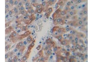 IHC-P analysis of Rat Liver Tissue, with DAB staining.