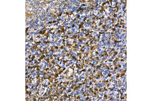 Immunohistochemistry (IHC) image for anti-Annexin A1 (ANXA1) antibody (ABIN6133581)