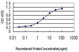 Detection limit for recombinant GST tagged MEFV is approximately 0. (MEFV Antikörper  (AA 1-110))