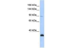 WB Suggested Anti-MORC3 Antibody Titration:  0. (MORC3 Antikörper  (N-Term))