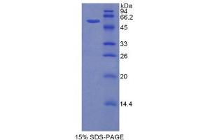 SDS-PAGE (SDS) image for Hexokinase 2 (HK2) (AA 605-868) protein (His tag,GST tag) (ABIN1878219)