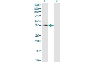 Western Blot analysis of PIPOX expression in transfected 293T cell line by PIPOX monoclonal antibody (M10), clone 3D1. (PIPOX Antikörper  (AA 292-384))