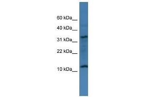 Western Blot showing C14orf177 antibody used at a concentration of 1-2 ug/ml to detect its target protein. (C14ORF177 Antikörper  (N-Term))