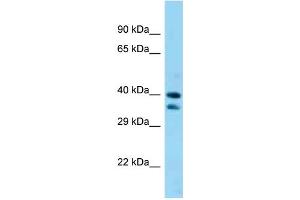 WB Suggested Anti-Sav1 Antibody Titration: 1. (SAV1 Antikörper  (C-Term))