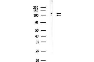 anti-Glutamate Receptor, Ionotropic, AMPA 4 (GRIA4) (Internal Region) antibody