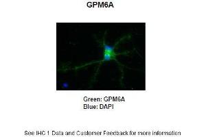 Primary Antibody Dilution: 1:250Secondary Antibody: Anti-rabbit-AlexaFluor 488 Secondary Antibody Dilution: 1:5000Color/Signal Descriptions: GPM6A: Green DAPI: Blue  Gene Name: GPM6A Submitted by: Anonymous