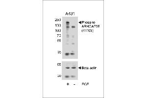 Western blot analysis of lysates from A431 cell line, untreated or treated with EGF, 100 ng/mL, using Phospho-HUN-ARHG (ABIN6241039 and ABIN6578944) (upper) or Beta-actin (lower). (GRLF1 Antikörper  (pTyr1105))