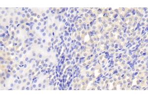 Detection of CLTA in Mouse Kidney Tissue using Polyclonal Antibody to Clathrin, Light Polypeptide A (CLTA) (CLTA Antikörper  (AA 5-234))
