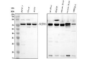 Western blot analysis of VTCN1 using anti-VTCN1 antibody (ABIN7602060).