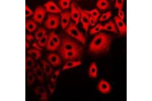 Immunofluorescent analysis of Calpain 5 staining in A549 cells.
