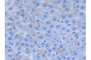 DAB staining on IHC-P; Samples: Rat Liver Tissue (alpha 2 Antiplasmin Antikörper  (AA 348-491))