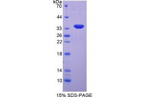 Image no. 1 for serum/glucocorticoid Regulated Kinase 2 (SGK2) (AA 40-311) protein (His tag) (ABIN6237981)