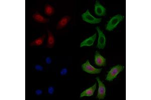ABIN7093314 and ABIN7097333 staining Hela cells by IF/ICC. (p53 Antikörper  (C-Term))