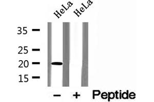 Western blot analysis of extracts of HeLa cells, using ARL3 antibody. (ARL3 Antikörper  (C-Term))