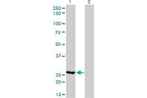 Western Blot analysis of MTHFD2 expression in transfected 293T cell line by MTHFD2 monoclonal antibody (M01), clone 4G7-2G3.