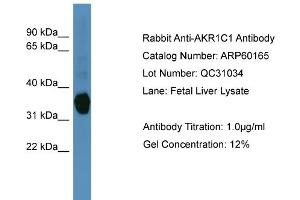 WB Suggested Anti-AKR1C1  Antibody Titration: 0. (AKR1C1 Antikörper  (N-Term))
