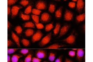 Immunofluorescence analysis of Hela cells using DNAJB14 Polyclonal Antibody at dilution of 1:100 (40x lens).