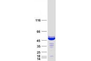 Western Blotting (WB) image for Homer Homolog 3 (Drosophila) (HOMER3) (Transcript Variant 2) protein (Myc-DYKDDDDK Tag) (ABIN2722958)