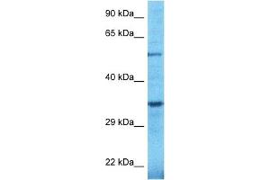 Host:  Rabbit  Target Name:  TULP2  Sample Type:  OVCAR-3 Whole Cell lysates  Antibody Dilution:  1.