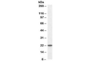 Western blot testing of K562 lysate with UBE2T antibody at 0. (Ube2t Antikörper)