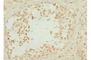 Immunohistochemistry of paraffin-embedded human testis tissue using ABIN7168204 at dilution of 1:100 (RPS6KL1 Antikörper  (AA 1-130))