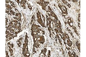 IHC analysis of NSF using anti-NSF antibody (ABIN7601630). (NSF Antikörper  (AA 4-636))