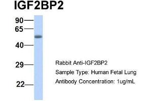 Host:  Rabbit  Target Name:  IGF2BP2  Sample Type:  Human Fetal Lung  Antibody Dilution:  1. (IGF2BP2 Antikörper  (Middle Region))