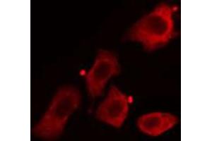 ABIN6268919 staining HuvEc cells by IF/ICC. (Caveolin-1 Antikörper  (C-Term))