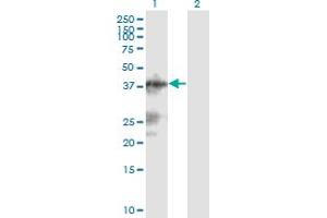 Western Blot analysis of C13orf31 expression in transfected 293T cell line by C13orf31 monoclonal antibody (M04), clone 2A1. (LACC1 Antikörper  (AA 1-430))