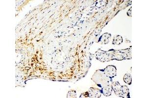 IHC-P: MCT5 antibody testing of human placenta cancer tissue (SLC16A4 Antikörper  (N-Term))