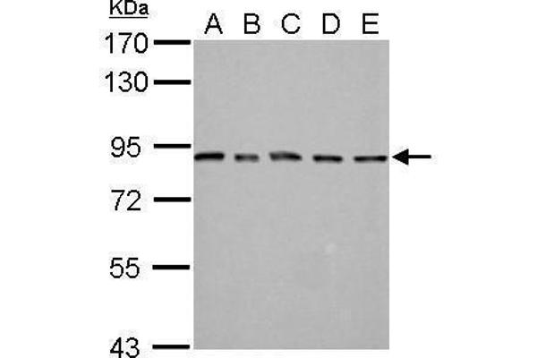 PSMD14 Antikörper  (Center)
