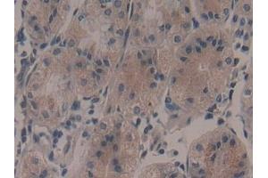 Immunohistochemistry (IHC) image for anti-Ribosomal Protein S6 Kinase, 90kDa, Polypeptide 1 (RPS6KA1) (AA 62-321) antibody (ABIN7441682)