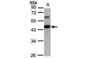WB Image Sample(30 ug whole cell lysate) A:293T 10% SDS PAGE antibody diluted at 1:2000 (CAMK4 Antikörper)