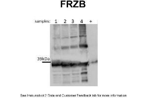 WB Suggested Anti-FRZB Antibody Titration: 0. (FRZB Antikörper  (N-Term))