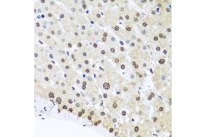 Immunohistochemistry (IHC) image for anti-Far Upstream Element (FUSE) Binding Protein 1 (FUBP1) (AA 302-644) antibody (ABIN6140802)
