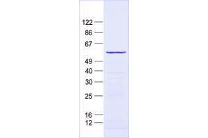 Validation with Western Blot (ZNF500 Protein (His tag))