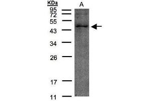 WB Image Sample(30 μg of whole cell lysate) A:HeLa S3, 12% SDS PAGE antibody diluted at 1:200 (TMLHE Antikörper)