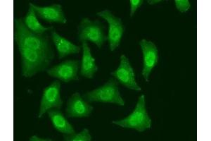 Immunofluorescence analysis of A549 cells using CDC5L Polyclonal Antibody (CDC5L Antikörper)