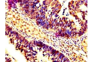 Immunohistochemistry (IHC) image for anti-Caspase 7, Apoptosis-Related Cysteine Peptidase (CASP7) (AA 24-198) antibody (ABIN7146960)