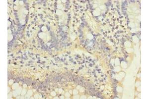 Immunohistochemistry of paraffin-embedded human small intestine tissue using ABIN7175029 at dilution of 1:100 (C5ORF22 Antikörper  (AA 101-420))