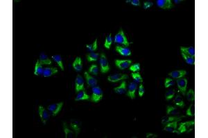 Immunofluorescence staining of Hela cells with ABIN7145792 at 1:66, counter-stained with DAPI. (BROX Antikörper  (AA 288-409))