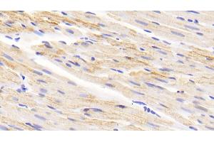 Immunohistochemistry (IHC) image for anti-Monoamine Oxidase A (MAOA) (AA 2-497) antibody (ABIN7440716)