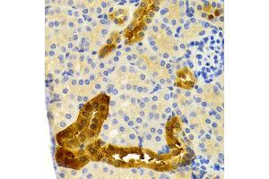 Immunohistochemistry of paraffin-embedded mouse kidney using PVALB antibody at dilution of 1:200 (400x lens).