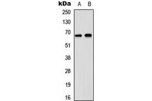 Western blot analysis of DDX5 expression in A431 (A), SHSY5Y (B) whole cell lysates. (DDX5 Antikörper  (C-Term))